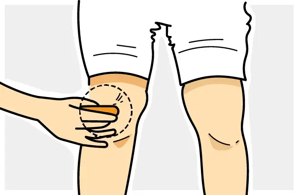 Applicare subito dopo l’urto