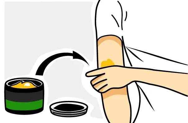 Applicare subito dopo il trauma