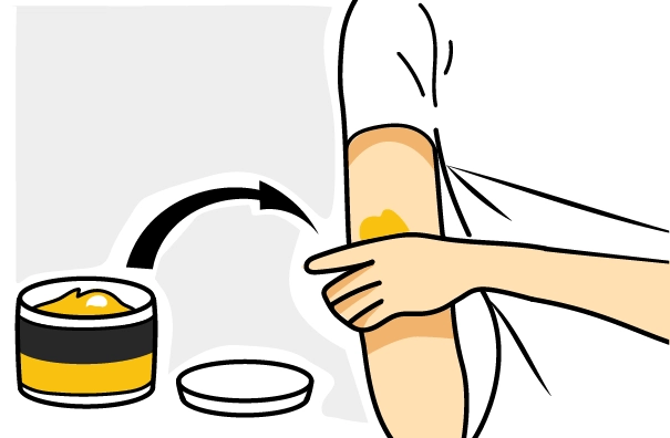 Applicare subito dopo il trauma